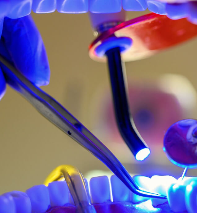 Otturazione Denti Cariati | Studio Dentistico Demetra