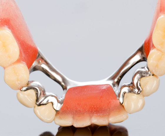 Protesi Dentali | Studio Dentistico Demetra