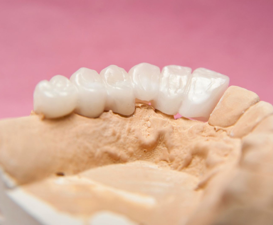 Protesi Dentarie | Studio Dentistico Demetra